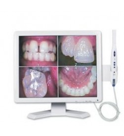 INTRAORAL CAMERA WITH MONITOR