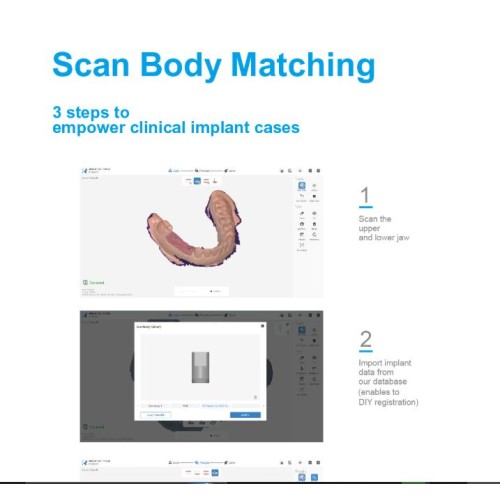 RUNYES 3DS INTRA ORAL SCANNER