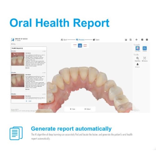 RUNYES 3DS INTRA ORAL SCANNER